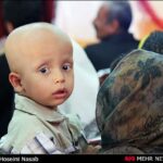 children with cancer- Iran
