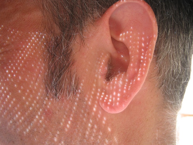 Ear Identification Scan