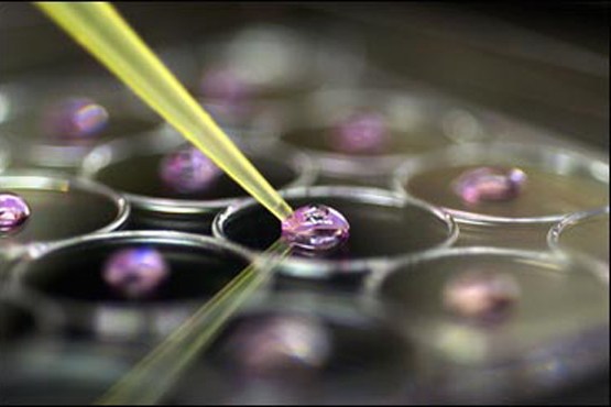 Iranian researcher cancer-resistant nanoparticles