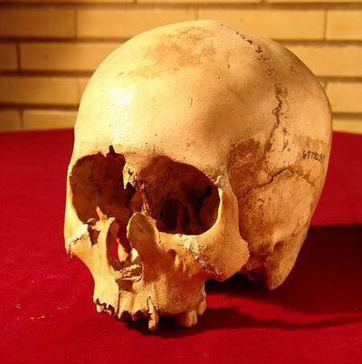 5,000-Year-Old Skull Reveals Iran’s Medical Advances