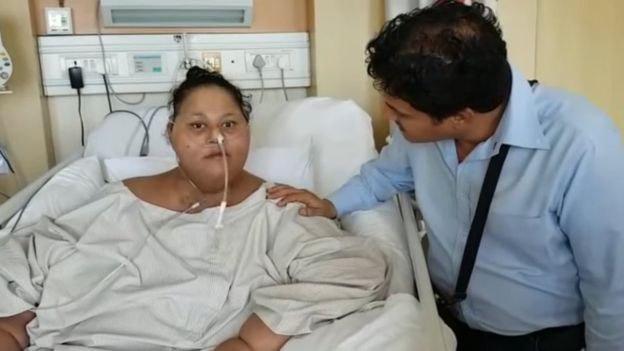 500kg Egyptian Loses Half Her Weight after Surgery in India
