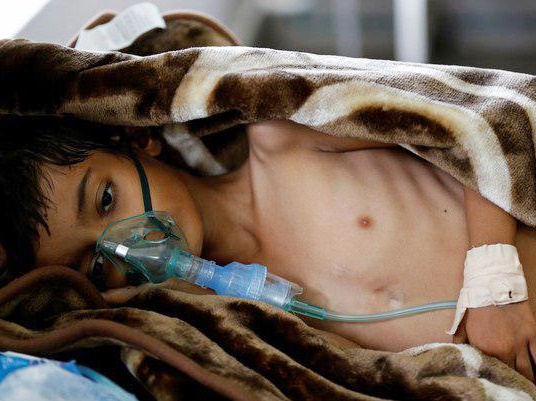 11,250 Yemenis Patients Die Due to Saudi Siege: Official