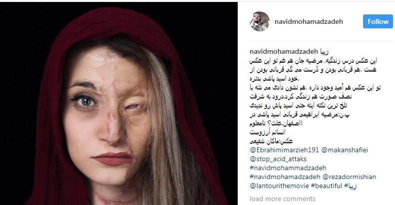 Wedding Ceremony of Iranian Acid Victim Goes Viral