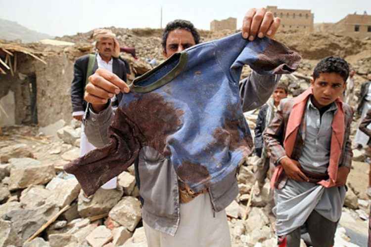 UN Puts Saudi-Led Coalition in Blacklist for Killing Yemeni Kids
