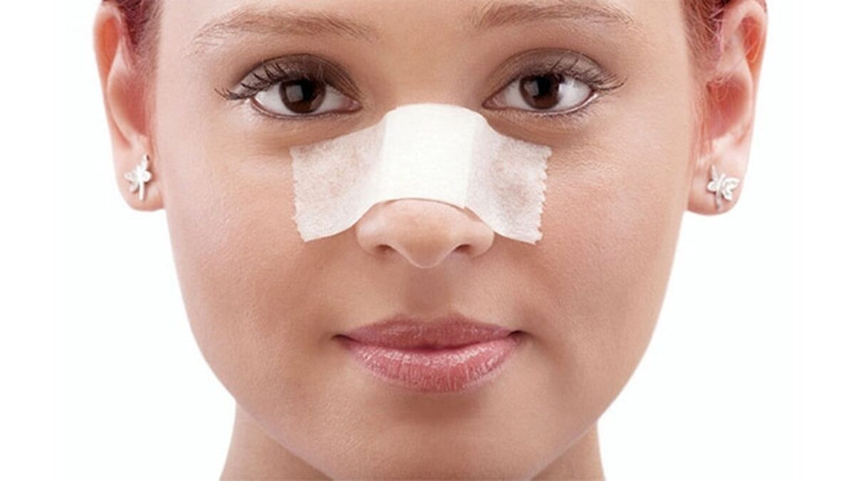 Rhinoplasty, a common cosmetic surgery