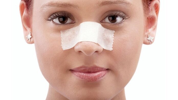 Rhinoplasty, a common cosmetic surgery