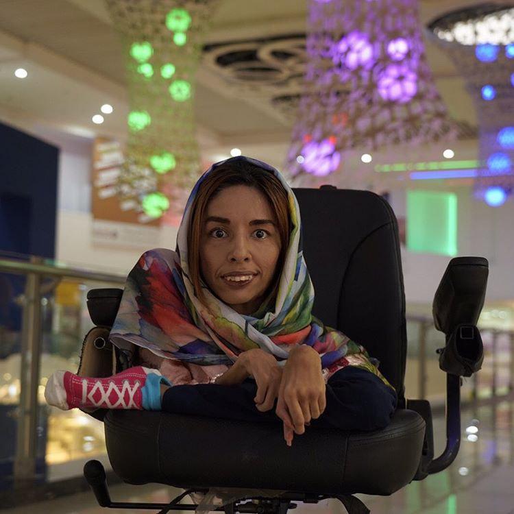 Iranian Girl Proves Disability Is Not Obstacle to Success