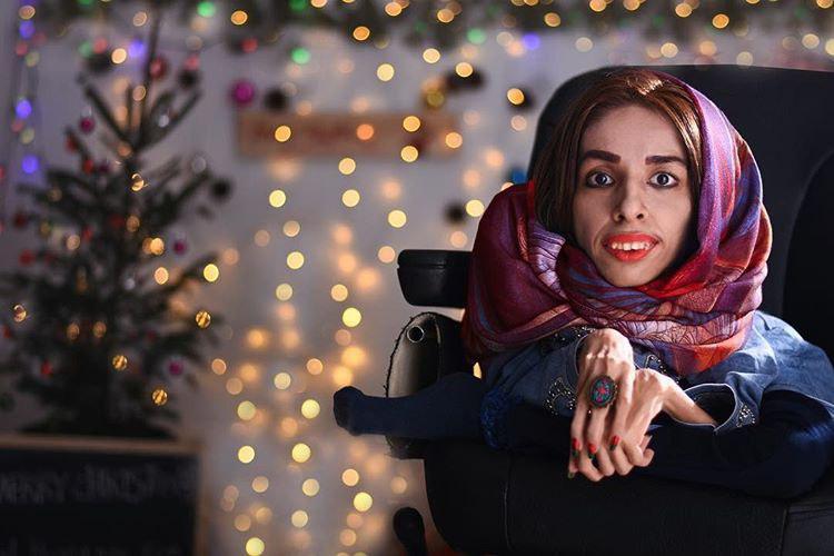 Iranian Girl Proves Disability Is Not Obstacle to Success