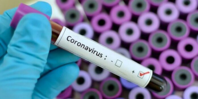 Coronavirus test
