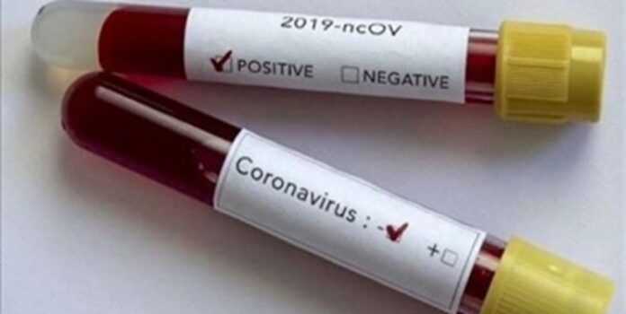 20-Minute COVID-19 Test