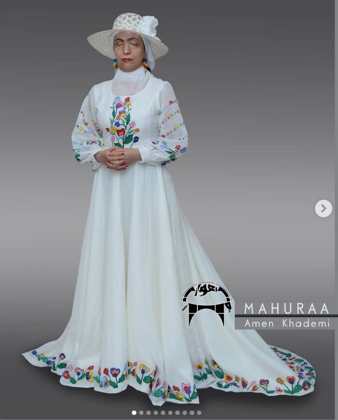 Iranian Acid Attack Victims Turn into Fashion Models