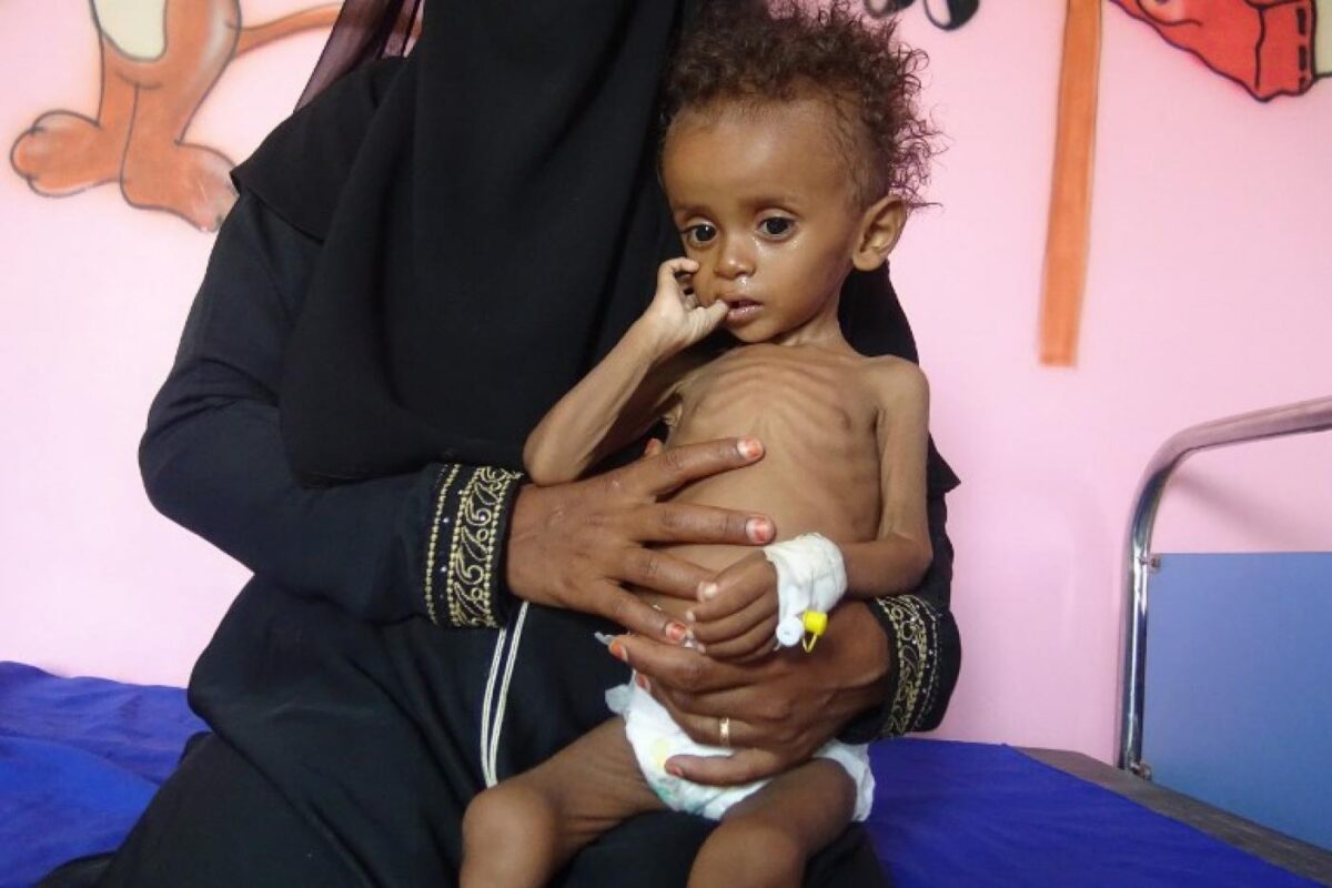 WHO: Over 16mn Yemenis engulfed in food insecurity