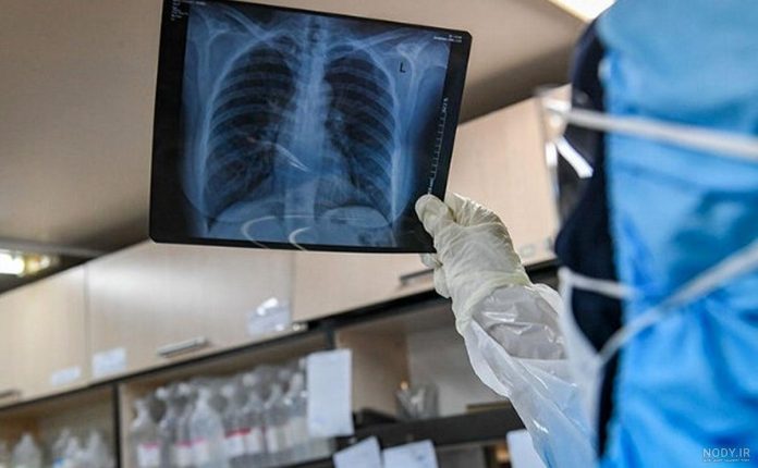 respiratory infection