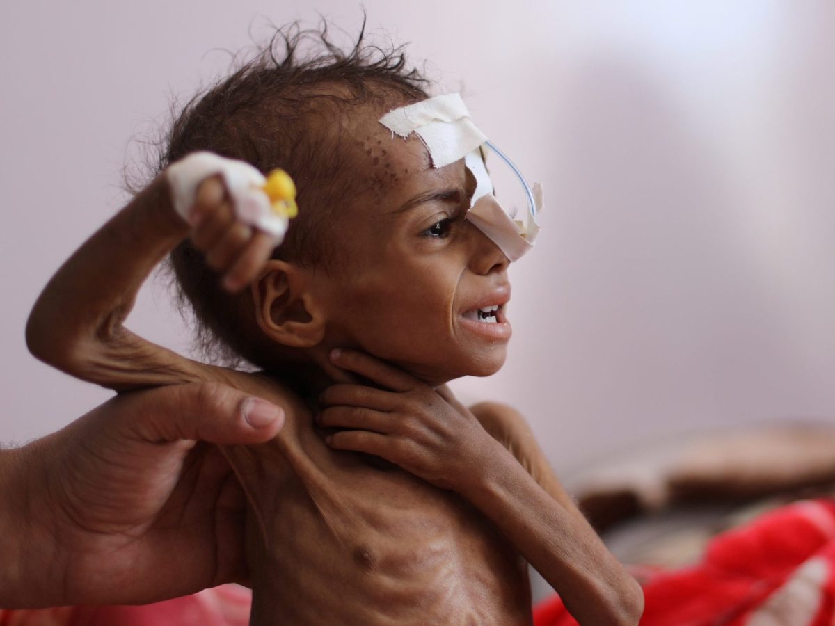 UN experts warn famine looming in parts of Yemen
