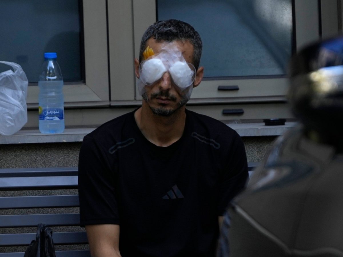 Iran treats 500 victims of Lebanon pager explosions 1 Lebanon Pagers Detonation