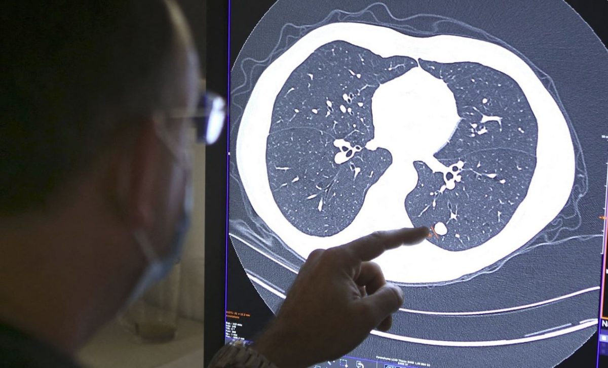 Iran's knowledge-based firm develops new nanodrug for cancer diagnosis 1 Cancer