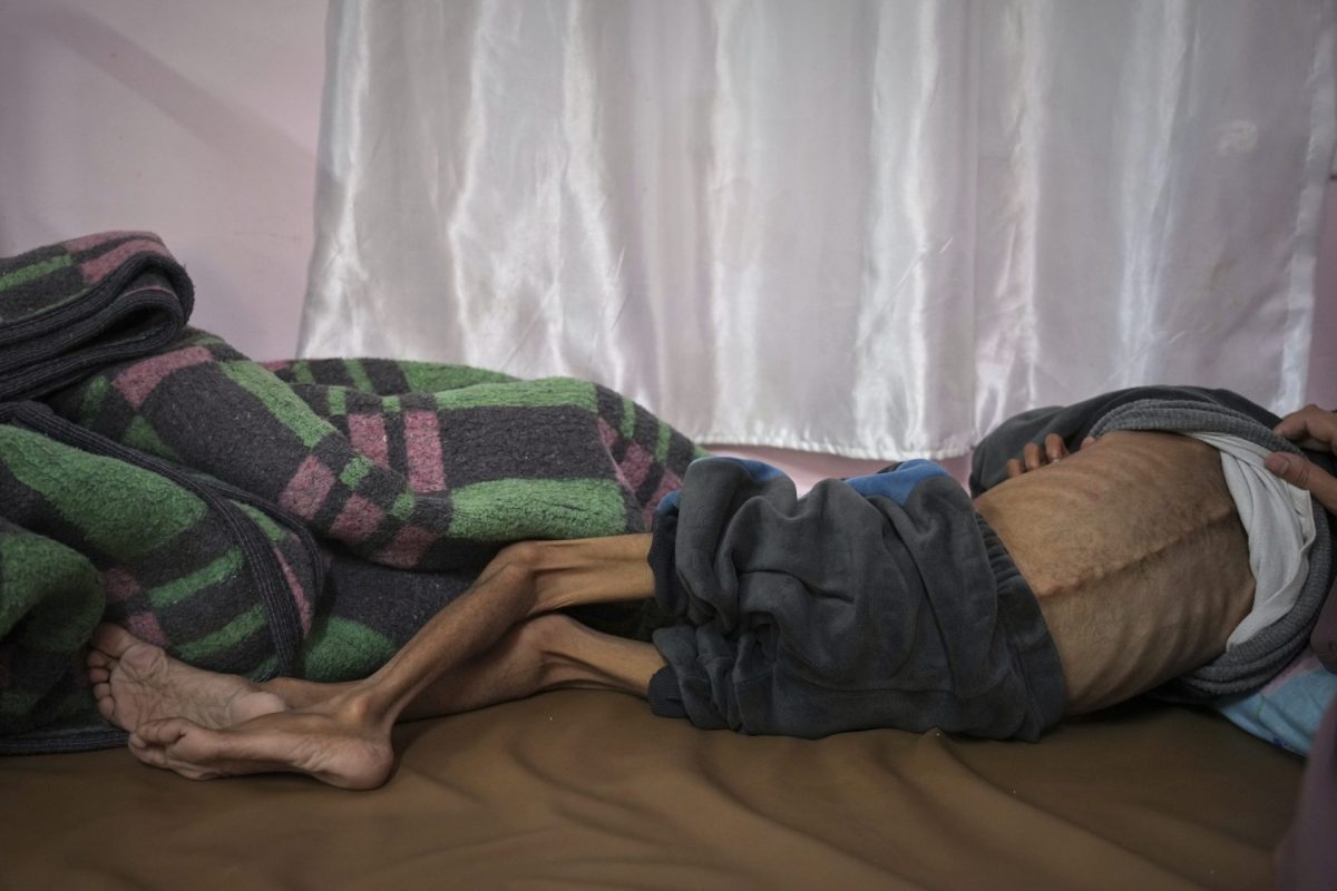 65,000 Gaza children facing death due to Israeli starvation policy 1 Gaza War