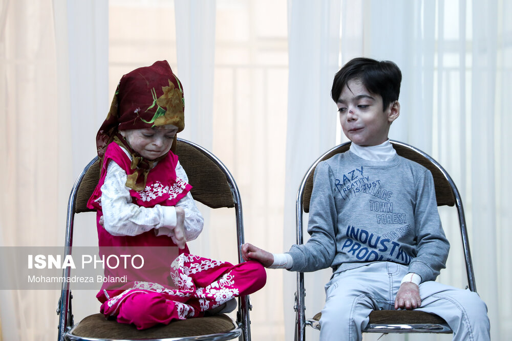 Iranian firm ready to mass-produce advanced dressings for EB patients, awaits institutional support 1 Iranian firm ready to mass-produce advanced dressings for EB patients, awaits institutional support